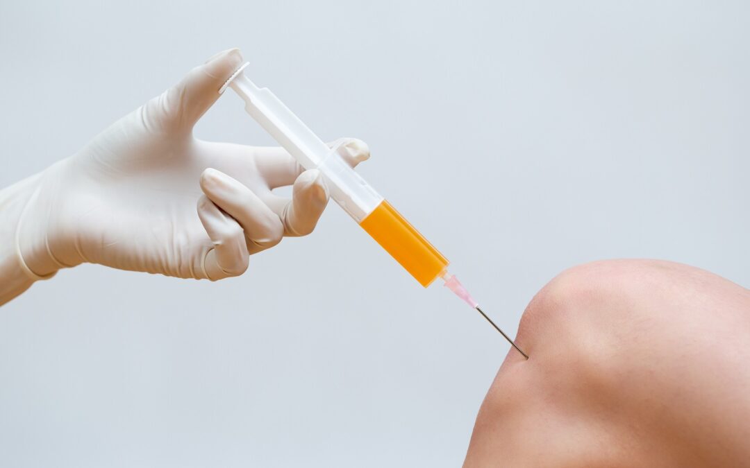 Doctor doing stem cell therapy on a patient knee after the injury using syringe with needle. Treating joint pain with platelet-rich plasma injection. Treatment of arthritis and osteoarthritis, stem Cell