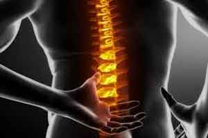 Back pain Treatment| stemcellmia | Platelet-rich plasma injections: an emerging therapy for chronic discogenic low back pain