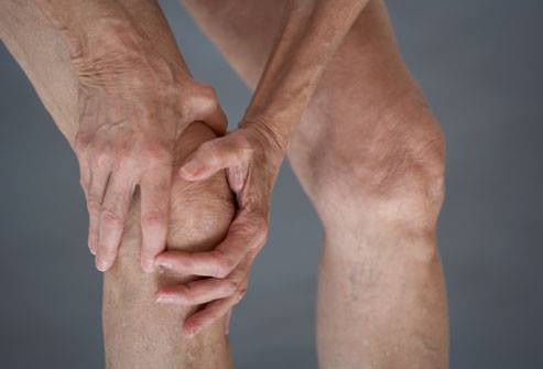Stopping arthritis before it starts