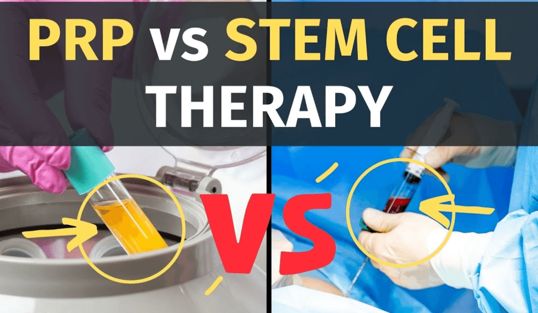 Stem Cell Therapy Vs. PRP Therapy