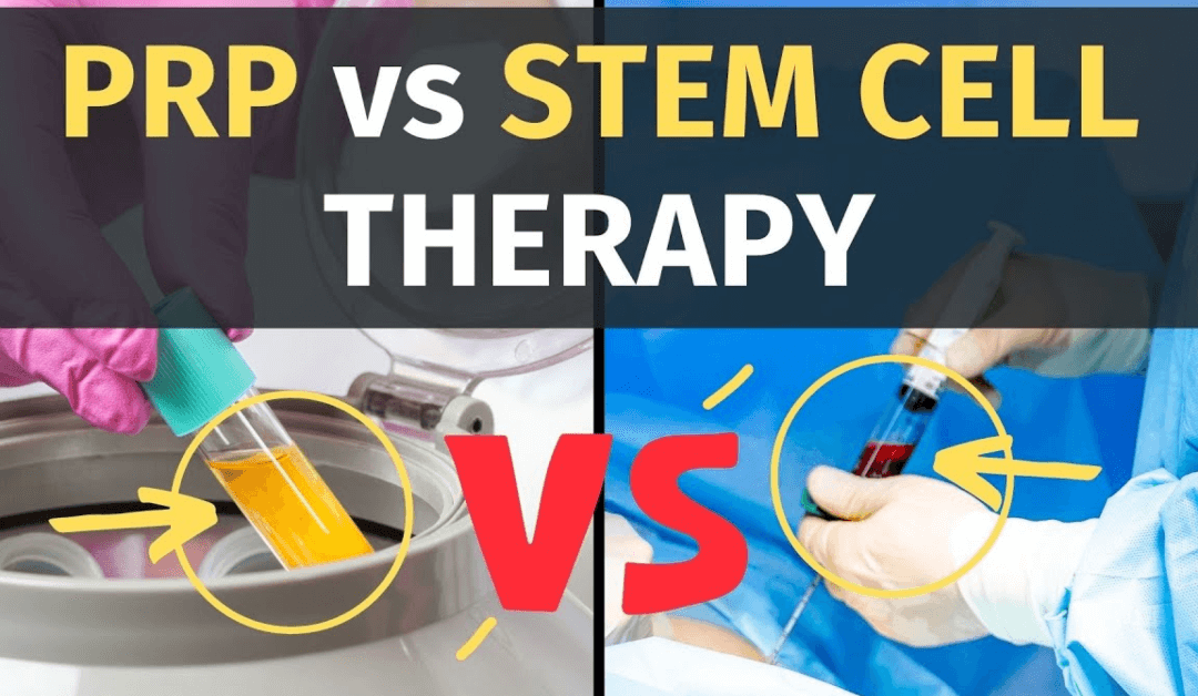 PRP Therapy vs. Stem Cell Therapy: What’s the Difference?
