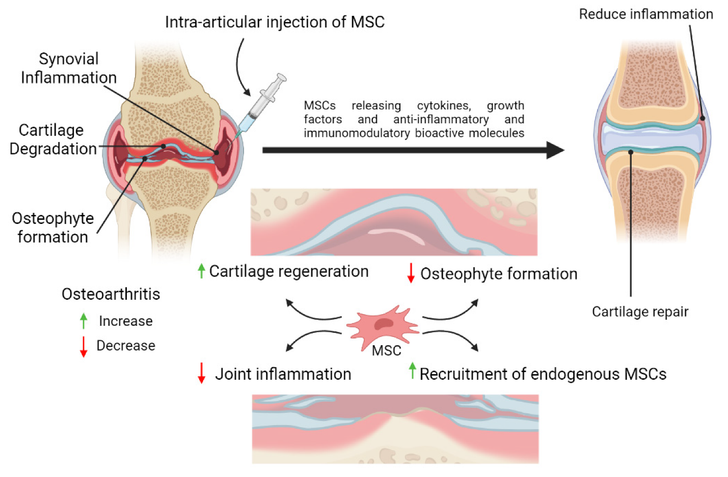 Mesenchymal Stem Cells (MSC) Therapy