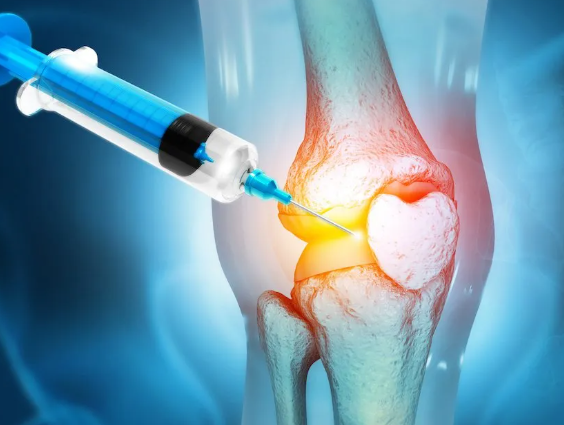 Stem cell injection into knee joint treating inflammation.