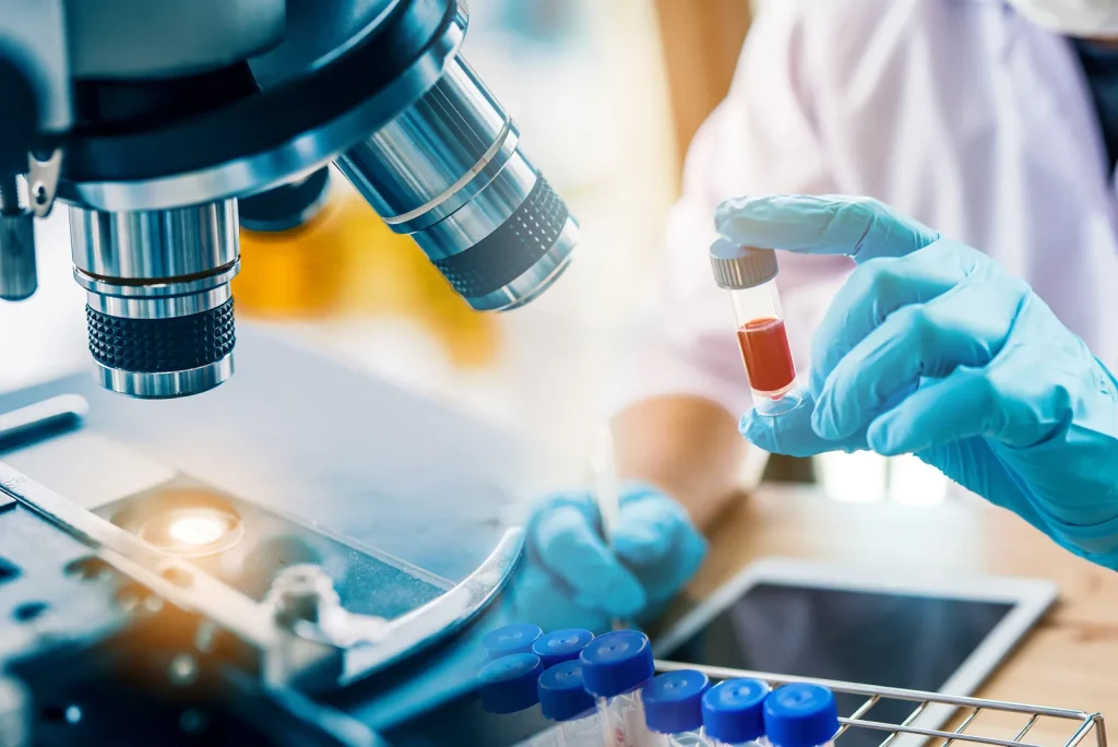Stem Cell Therapy