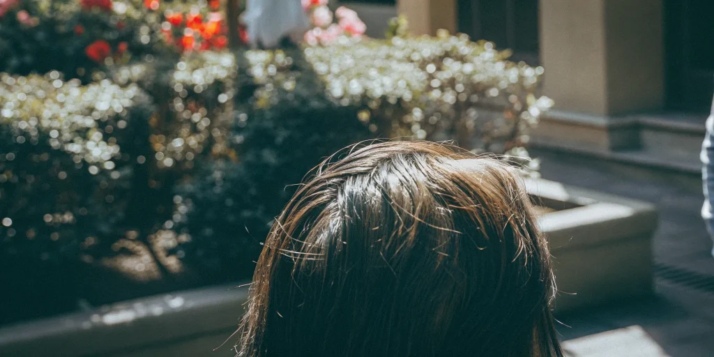 Close-up of thinning hair on a scalp, a candidate for exosome therapy vs PRP.