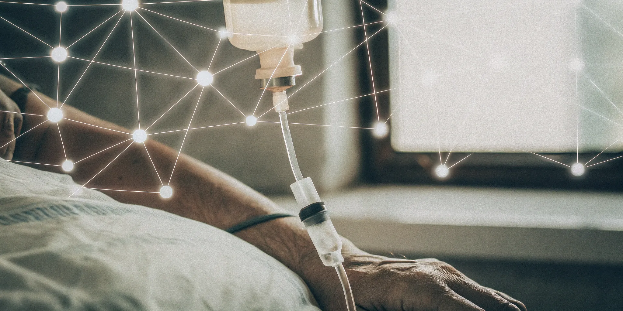 A patient receives a stem cell exosome infusion for multiple sclerosis treatment.