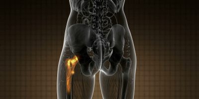 hip-bones-anatomy-medical-scan-SBI-350082136